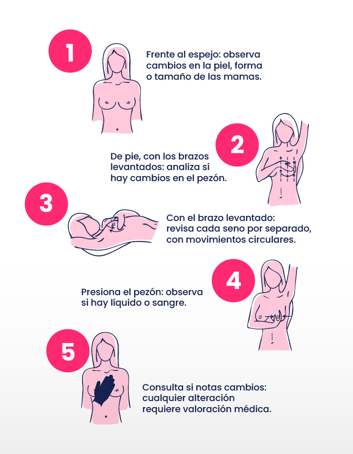 1. Frente al espejo: observa cambios en piel, forma o tamaño de las mamas. 2. De pie, con los brazos levantados: analiza si hay cambios en pezón. 3. Con el brazo levantado: revisa cada seno por separado, con movimientos circulares. 4. Presiona el pezón: observa si hay líquido o sangre. 5. Consulta si notas cambios: cualquier alteración requiere valoración médica.